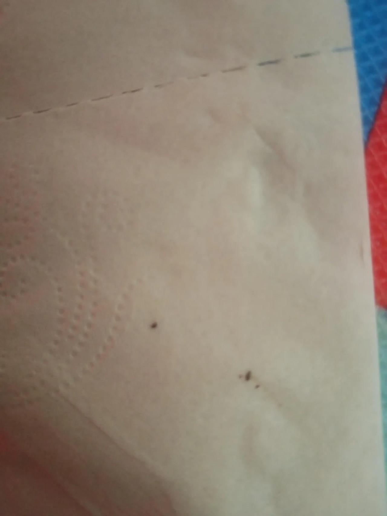 发现阴虱十多天了喷了药也不管用，又出来了2个，崩溃了，怎么才能好啊