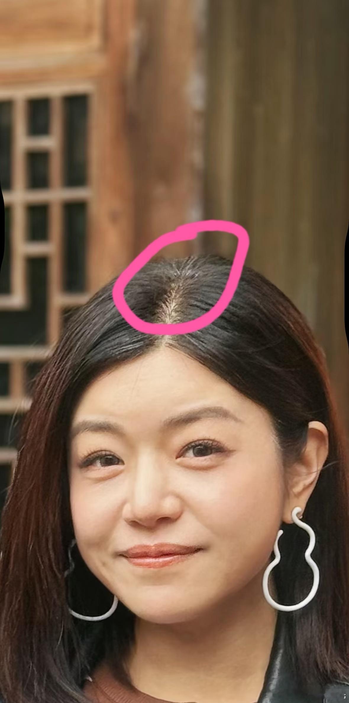 陈妍希白发42岁陈妍希有白发了 网友偶遇陈妍希并合影，po上网以后其他网友发现4
