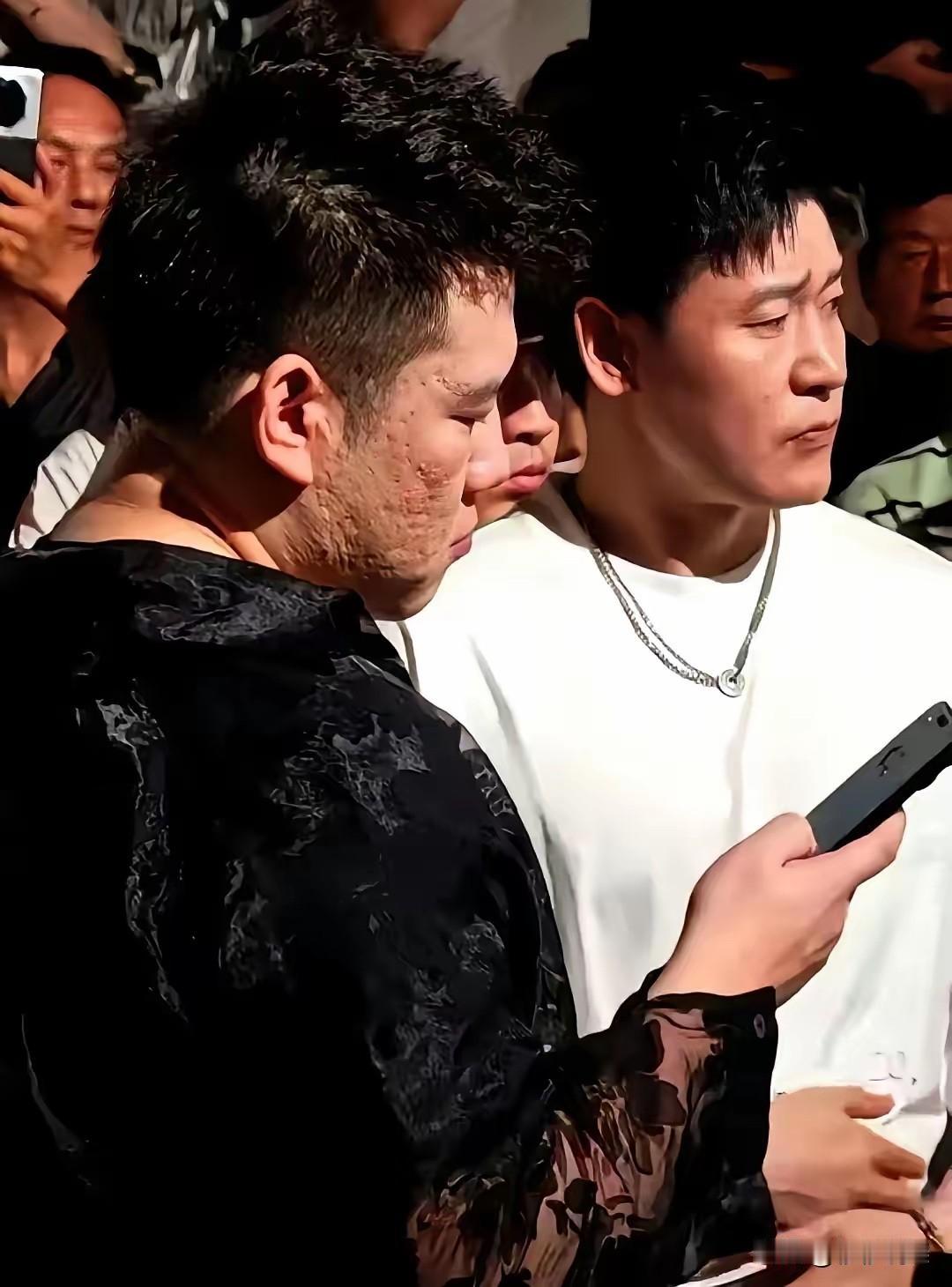 据说这是木森真实的脸？到底是相机拍摄的问题？还是他本人的脸就是这样？

经常玩抖