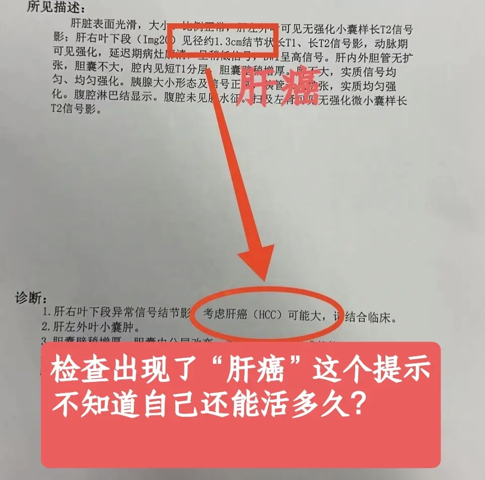 “我今年62岁，是乙肝进展成的肝癌，前些天跟着孩子公司体检突然发现的。...