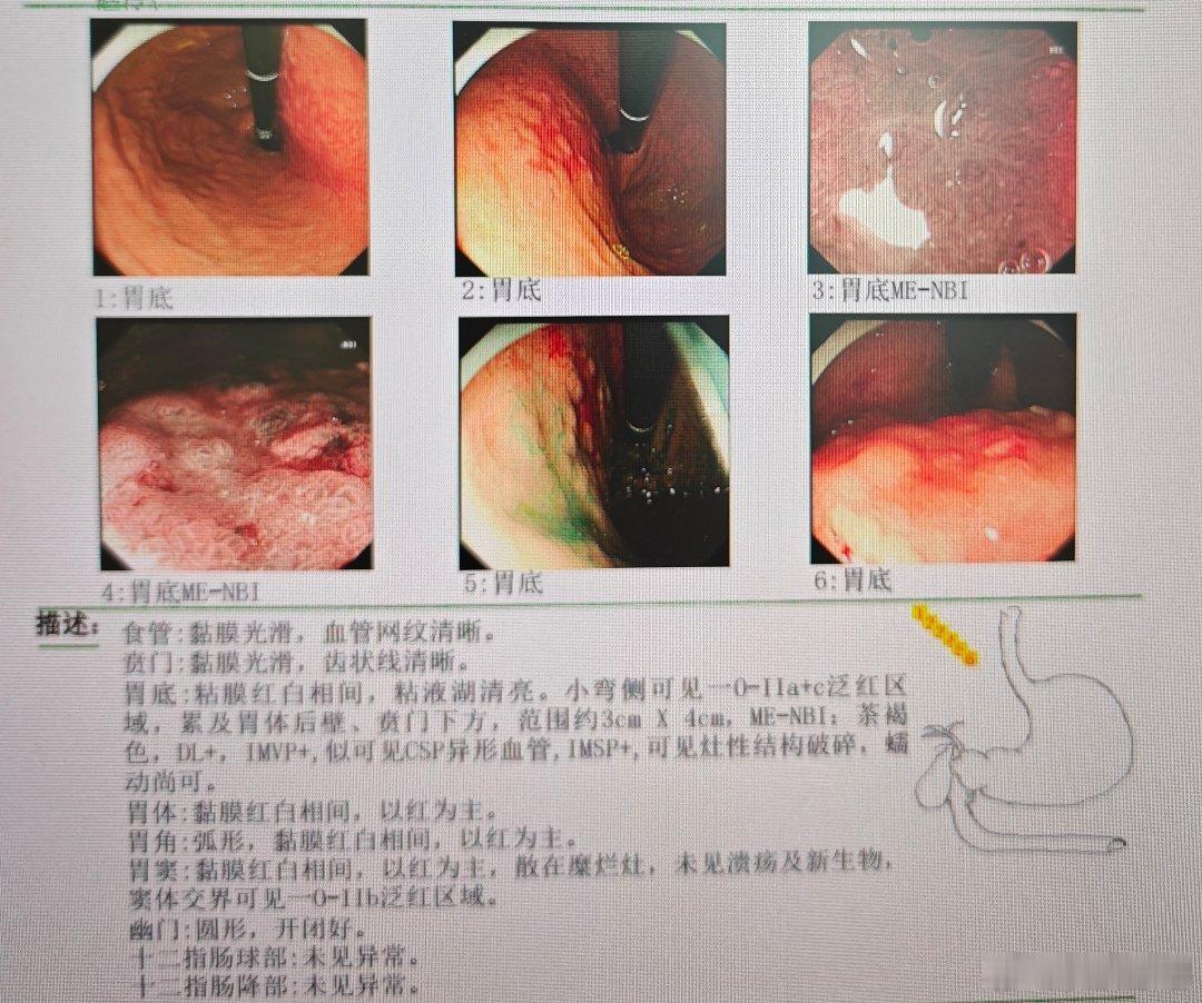 高倍放大内镜，看多了容易头晕，这个有点让人无解。 ​​​
