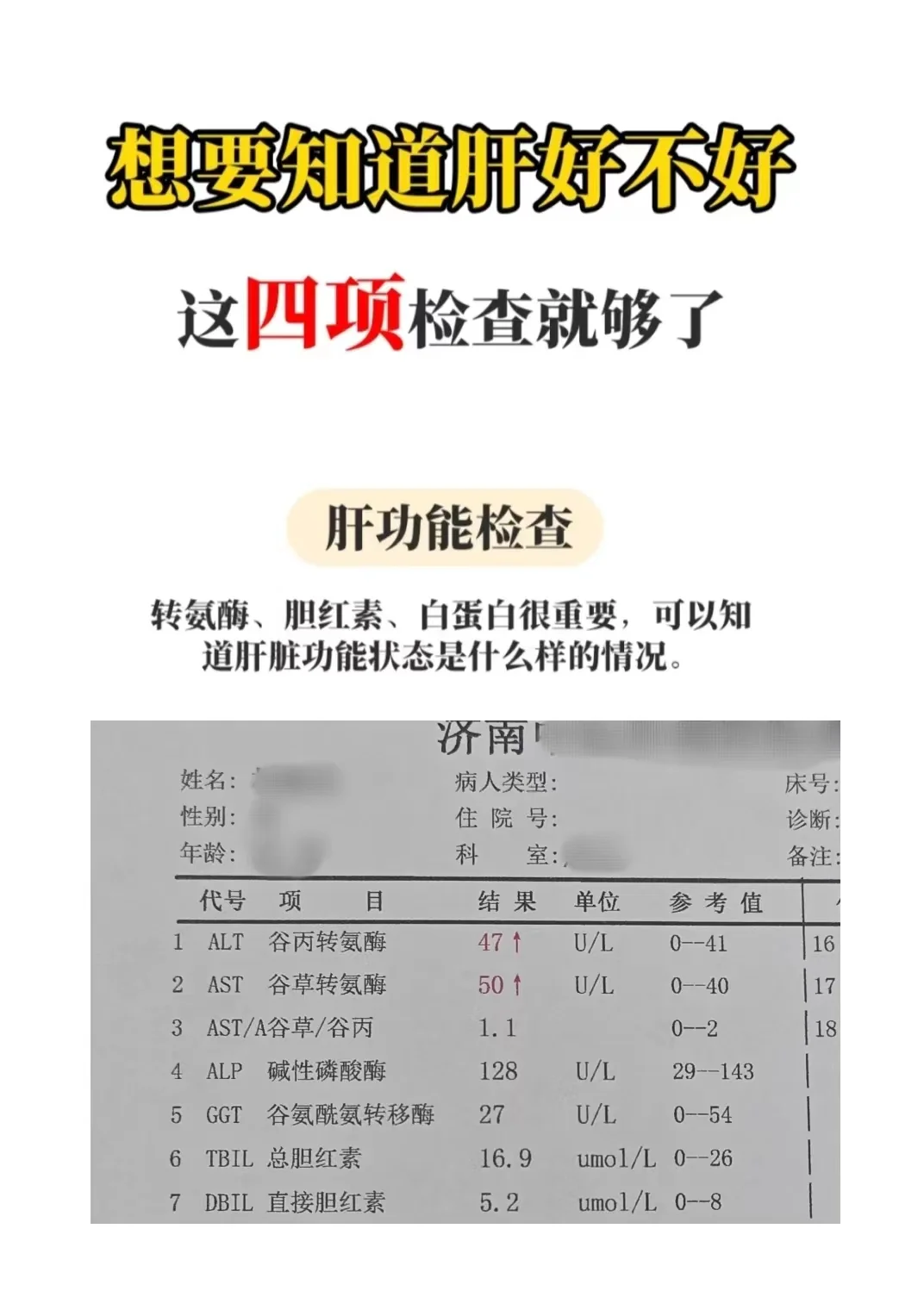 想知道肝好不好，做这4项检查就够了！