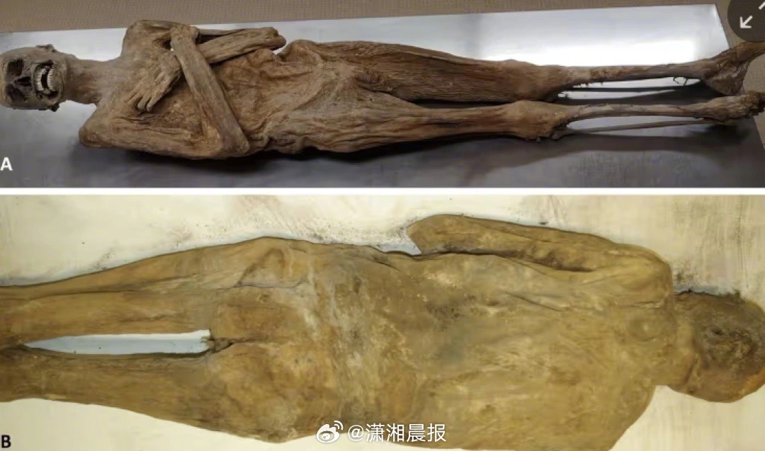 【#奥地利木乃伊经直肠灌物防腐#，#木乃伊被木屑丝绸氯化锌等填充防腐#】近日，奥