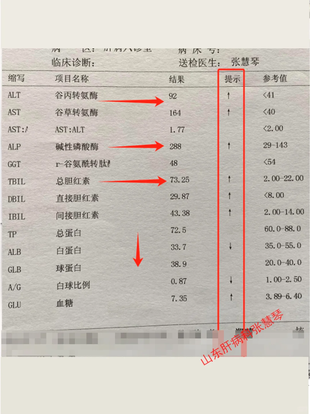 别忽视！肝功能出现3高1低，说明肝病加重了