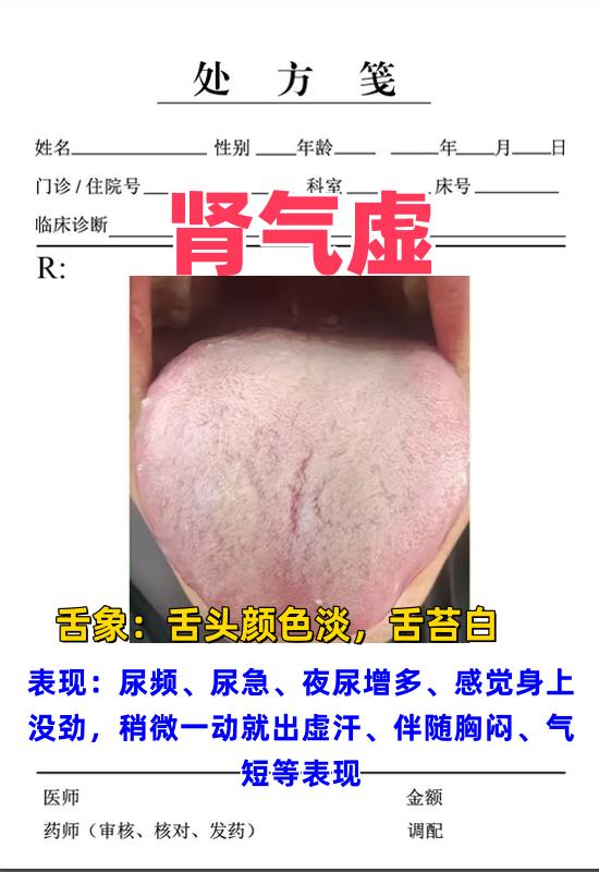 观舌象晓健康，舌象上能反映出不同的问题，不会看的朋友，可以拍下你的舌象，我来帮你