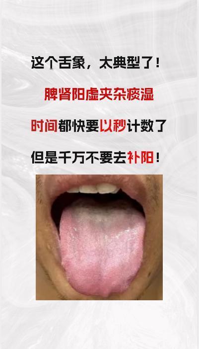 看这个舌象，典型的 脾肾阳虚+痰湿，时间都以秒来算，但也不要补阳