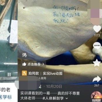 最近接连在网上看到好几条让人心里堵得慌的消息，先是有人拍到实训用的骨骼标本上，被