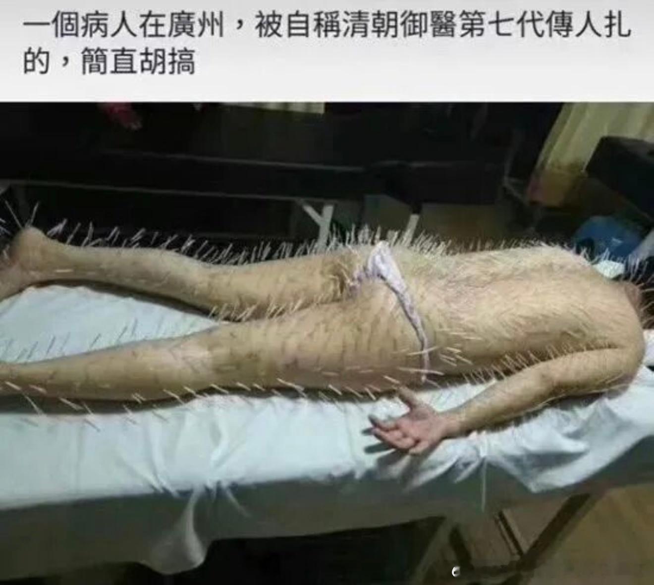 6415朋友，你是怎么祛湿气的？朋友回： 