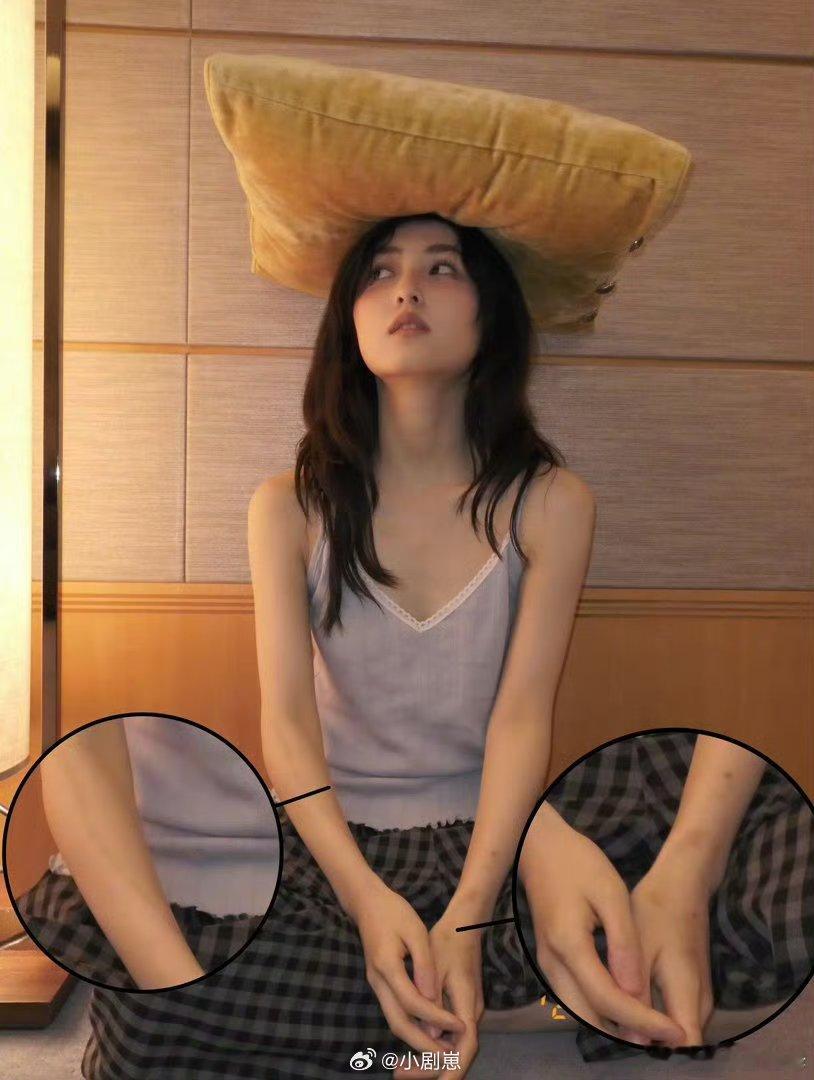 张子枫手臂都是伤疤张子枫拍戏真的好努力，小小年纪手臂都是伤疤，看得我好心疼，真的