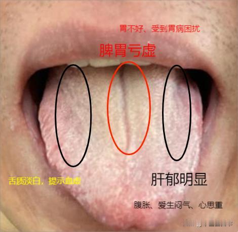 你留，我就看！留下你的舌象，我挨个帮大家分析