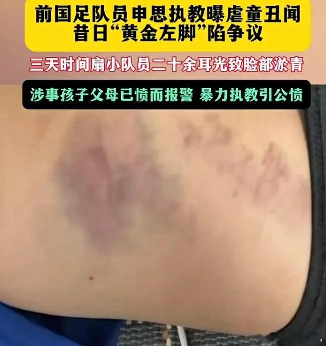 前国脚申思与祁宏因青训掌掴事件再次引爆舆情，中国足协于7月18日紧急重申二人早在