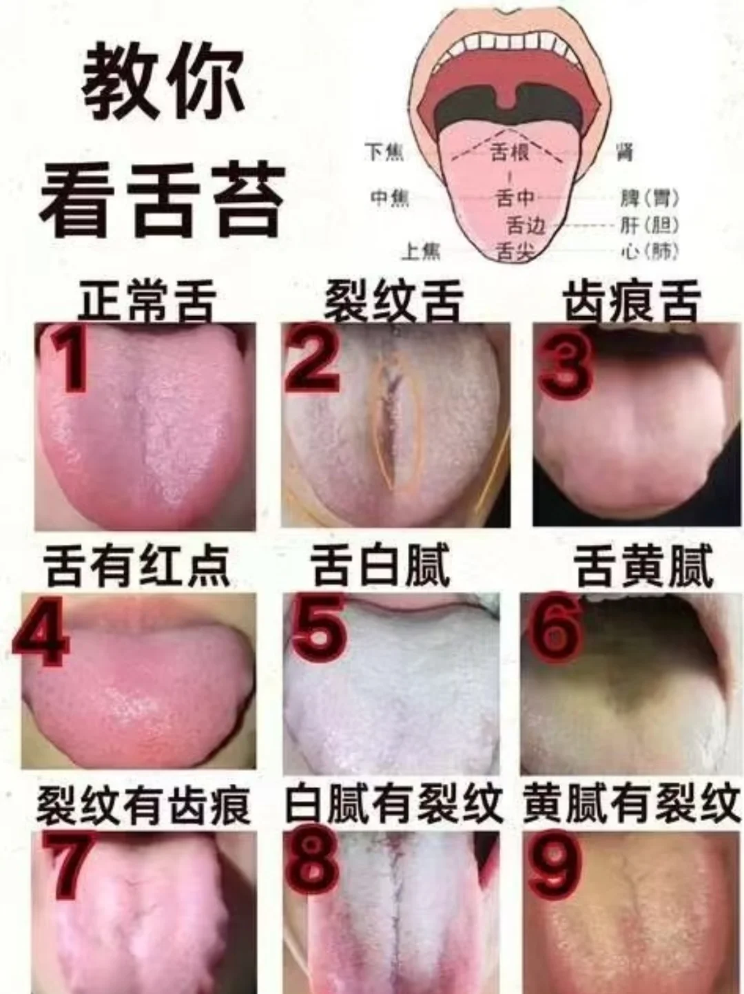 从舌头看健康