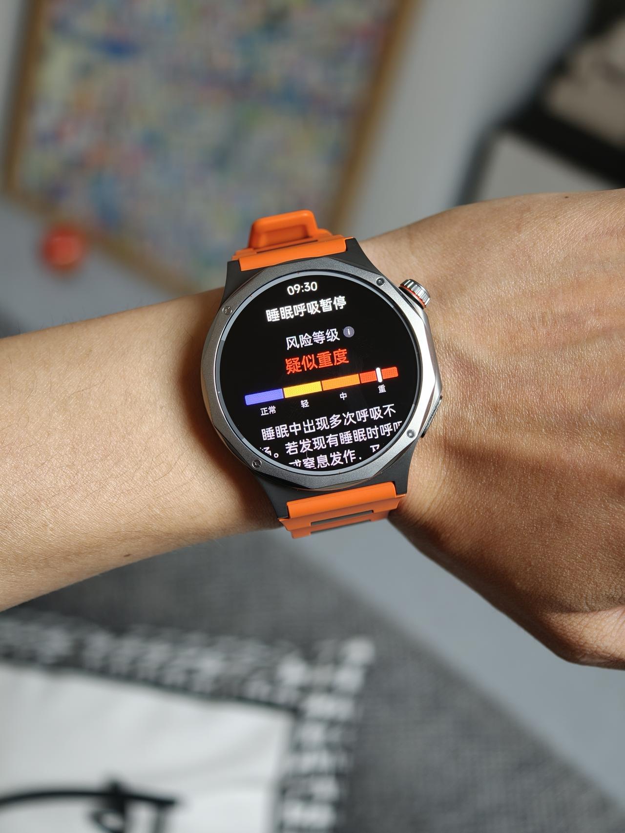 被oppowatchX3吓到，呼吸暂停要去看医生吗

今天大早上的被这块手表吓精