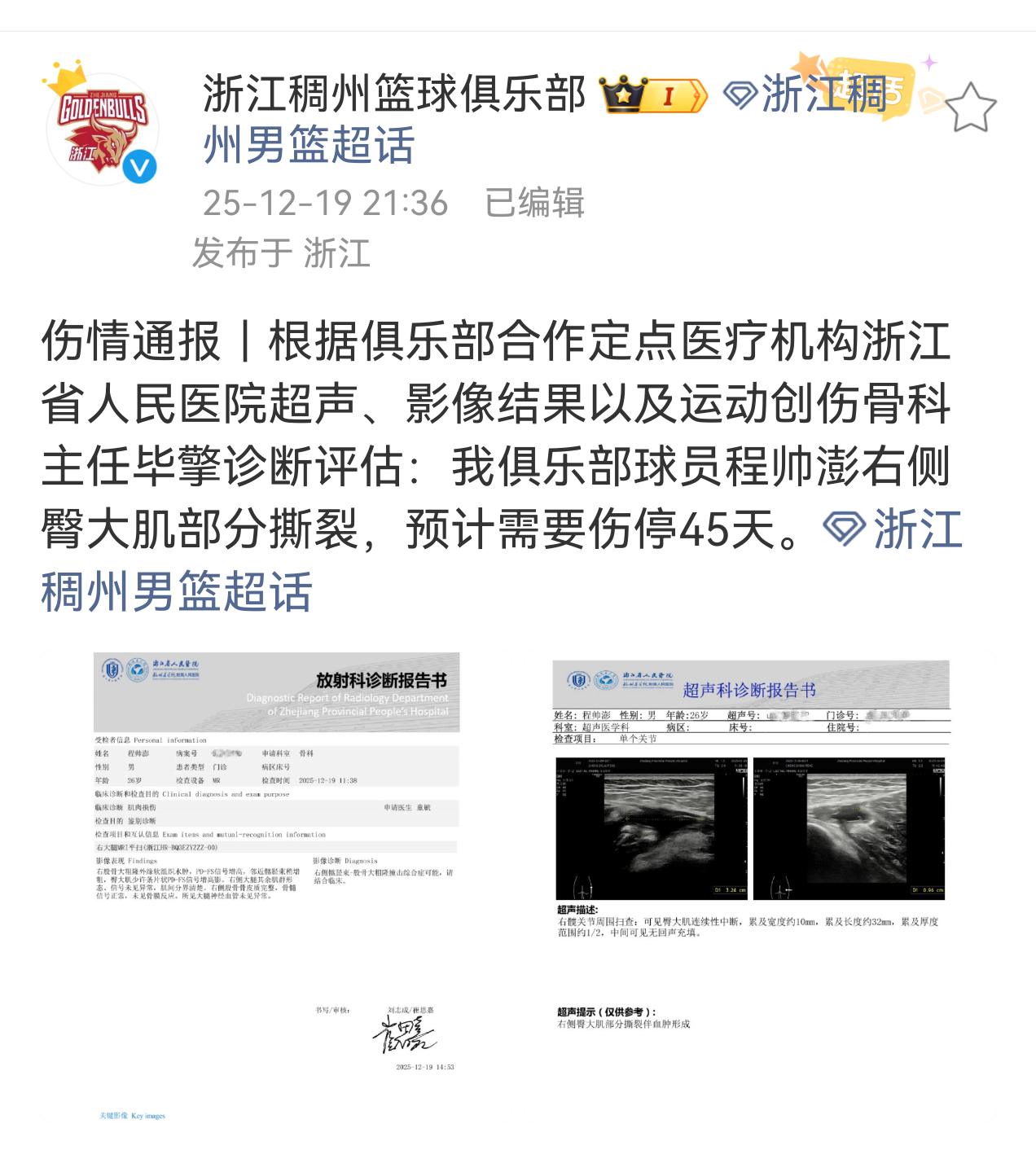 完了，国家队又伤一个后卫。程帅澎这边伤情官宣了，大腿右侧臀大肌撕裂，45天恢复期