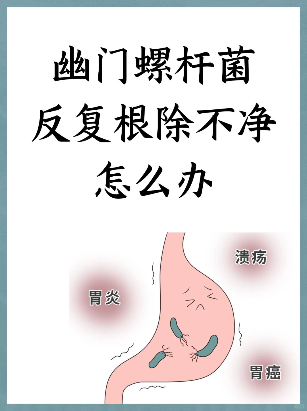 幽门螺杆菌反复根除不净怎么办？
