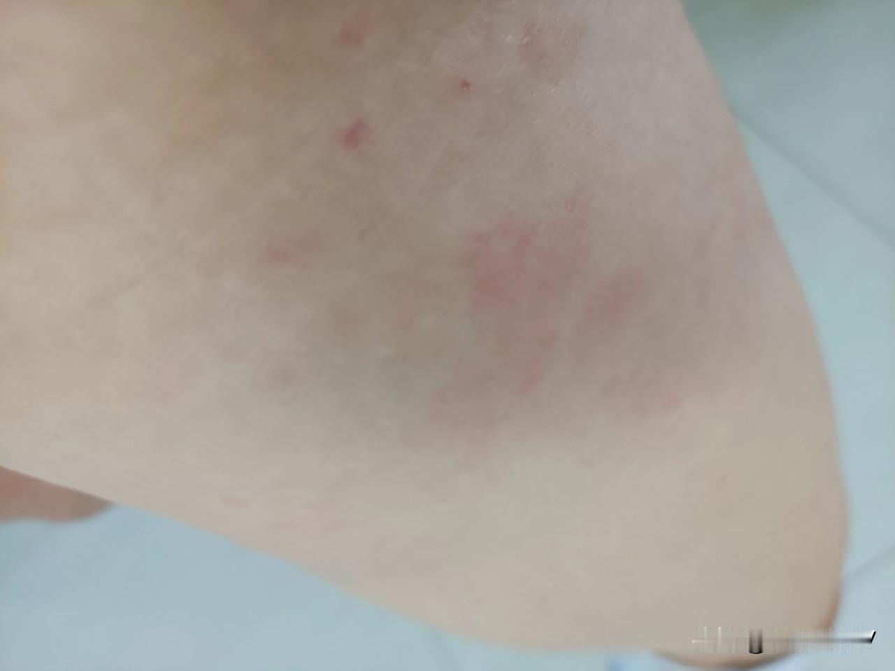 #秋日生活打卡季#
发现没有？人老了这病就像在兜里揣的一样，说来就来了。

昨天