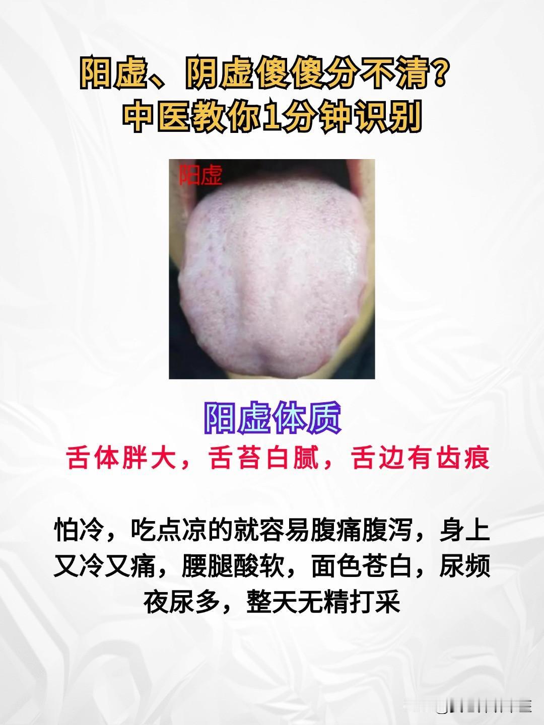 阳虚、阴虚傻傻分不清？中医教你1分钟识别！