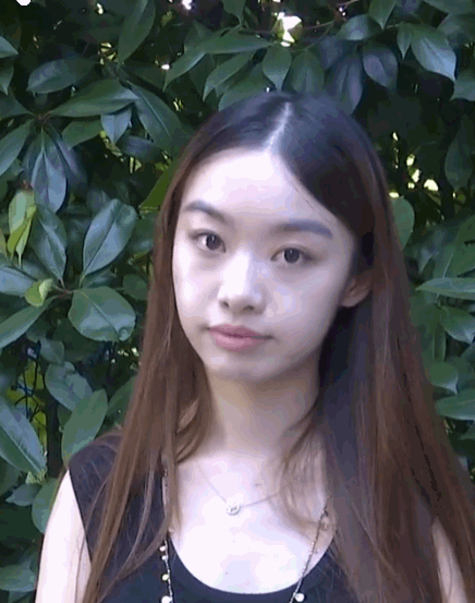 事出反常必有妖！杭州，一女子一家医美机构购买了5万元的下颌线提升项目。本以为能脱