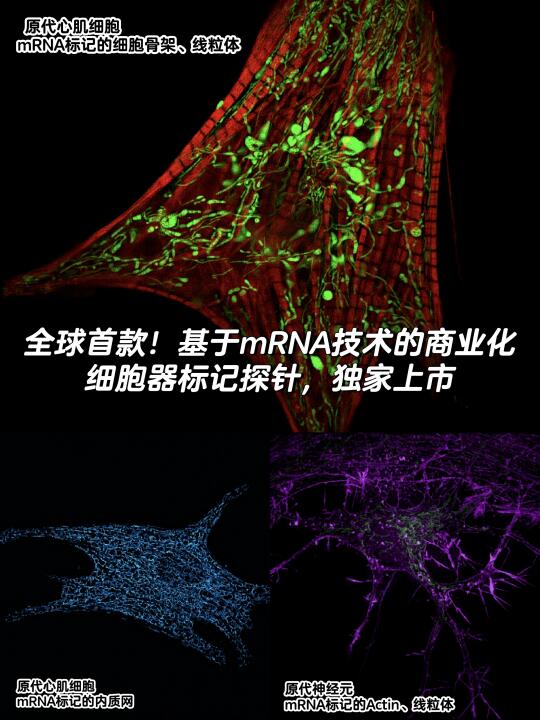 全球首发上市！基于mRNA的细胞器超分辨探针