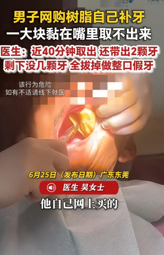 “得不偿失啊！”6月25日报道，广东东莞，一男子网购树脂补牙， 没想到在操作过程