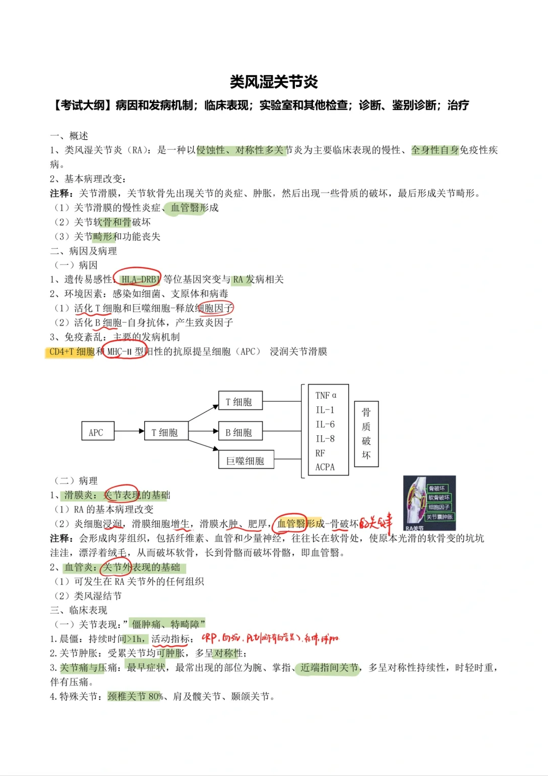 内科学-类风湿性关节炎