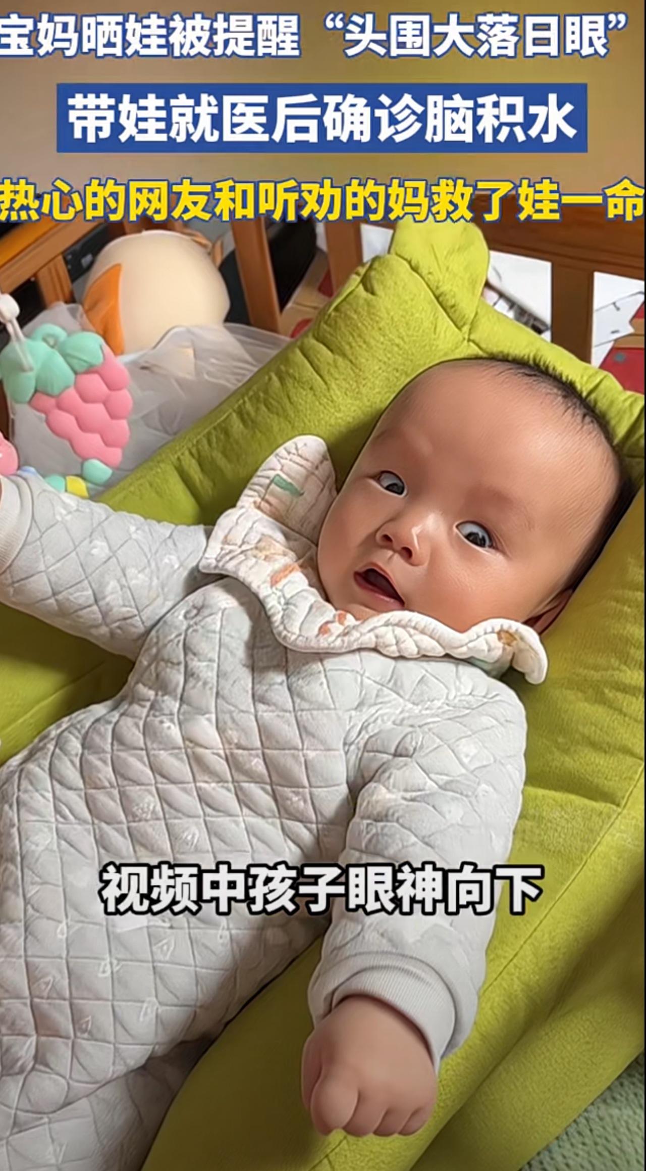 宝妈晒娃被热心网友成功提醒“头围大落日眼”，大家纷纷让她带娃就医检查但是她曾经带