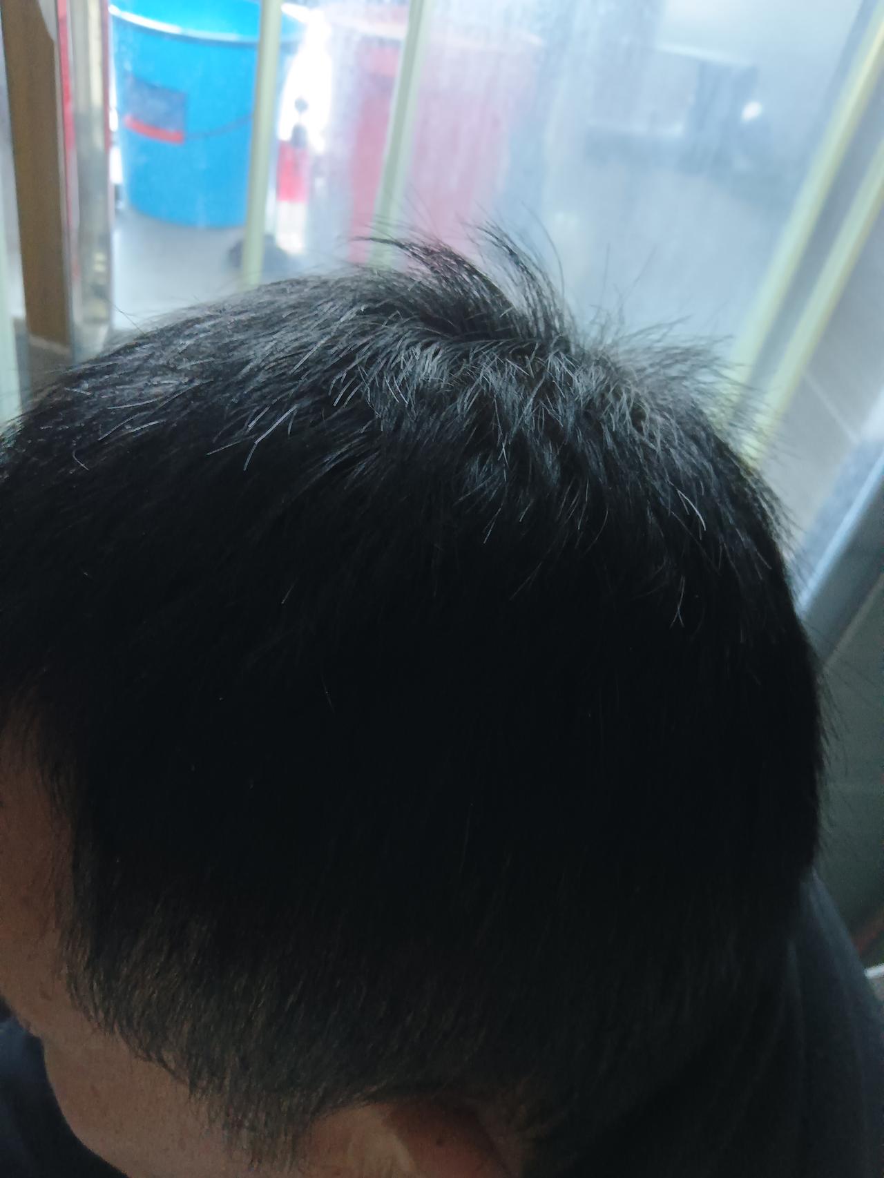 白头发十秒钟变黑，
这不是吹的是真的。

由于老公最近常加班加点工作，
所以头上