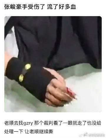 张峻豪流了好多血张峻豪流血了 啊啊啊 这也太严重了吧 