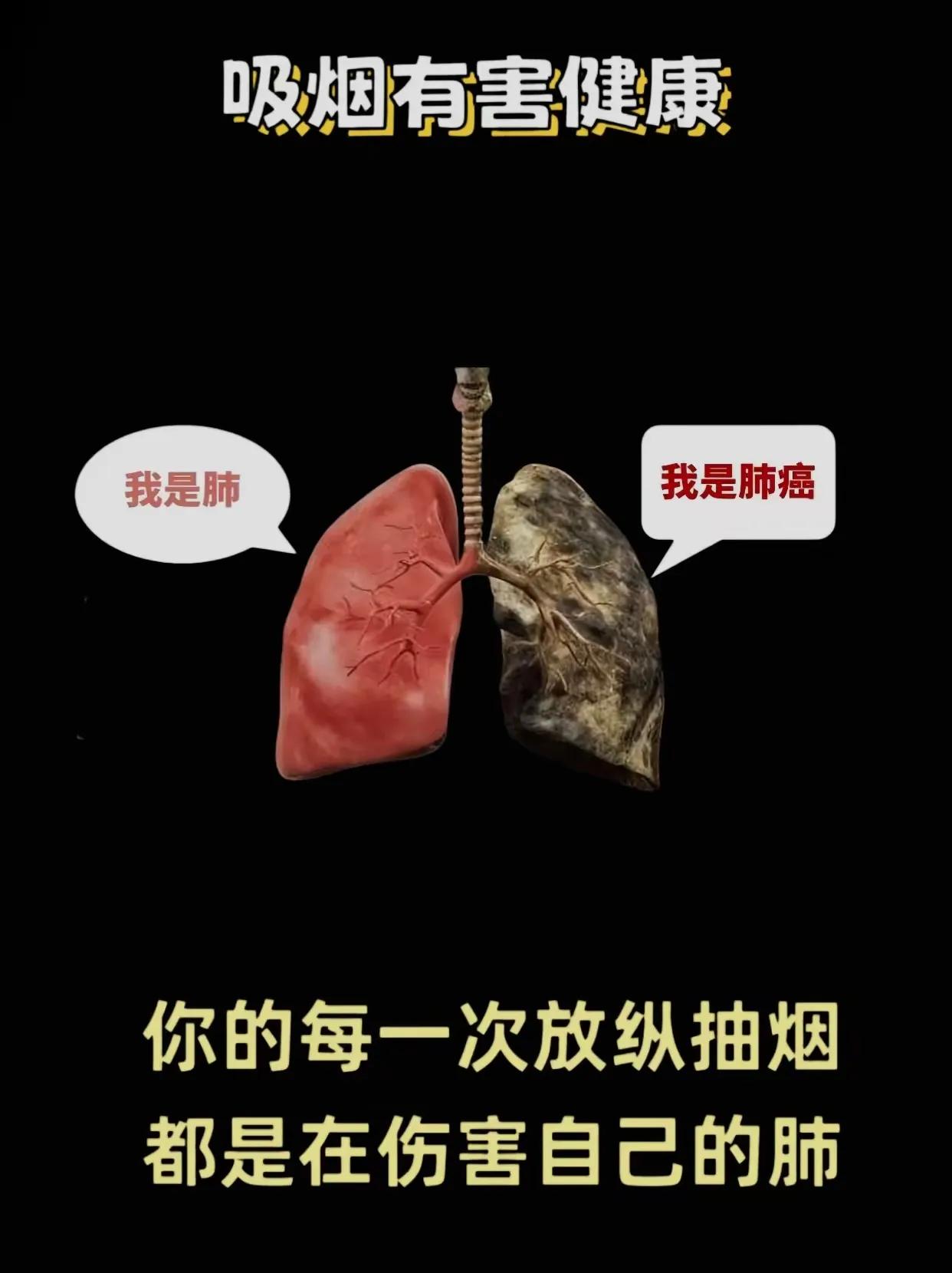 你的每一次放纵抽烟都是在伤害自己的肺你已戒烟了吗 你考虑过戒烟吗 戒烟就挺难的?