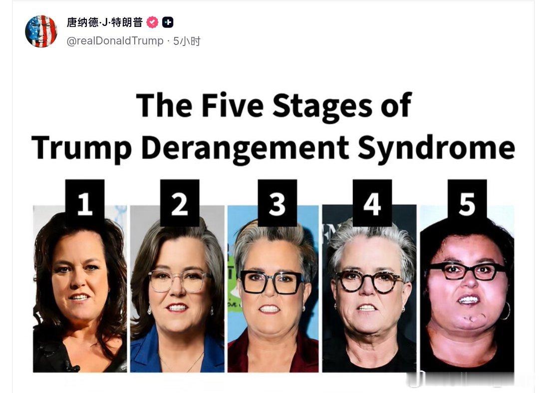 特朗普：特朗普精神错乱综合症的5个阶段。——我先发点招笑的。然后录个屏特式幽默
