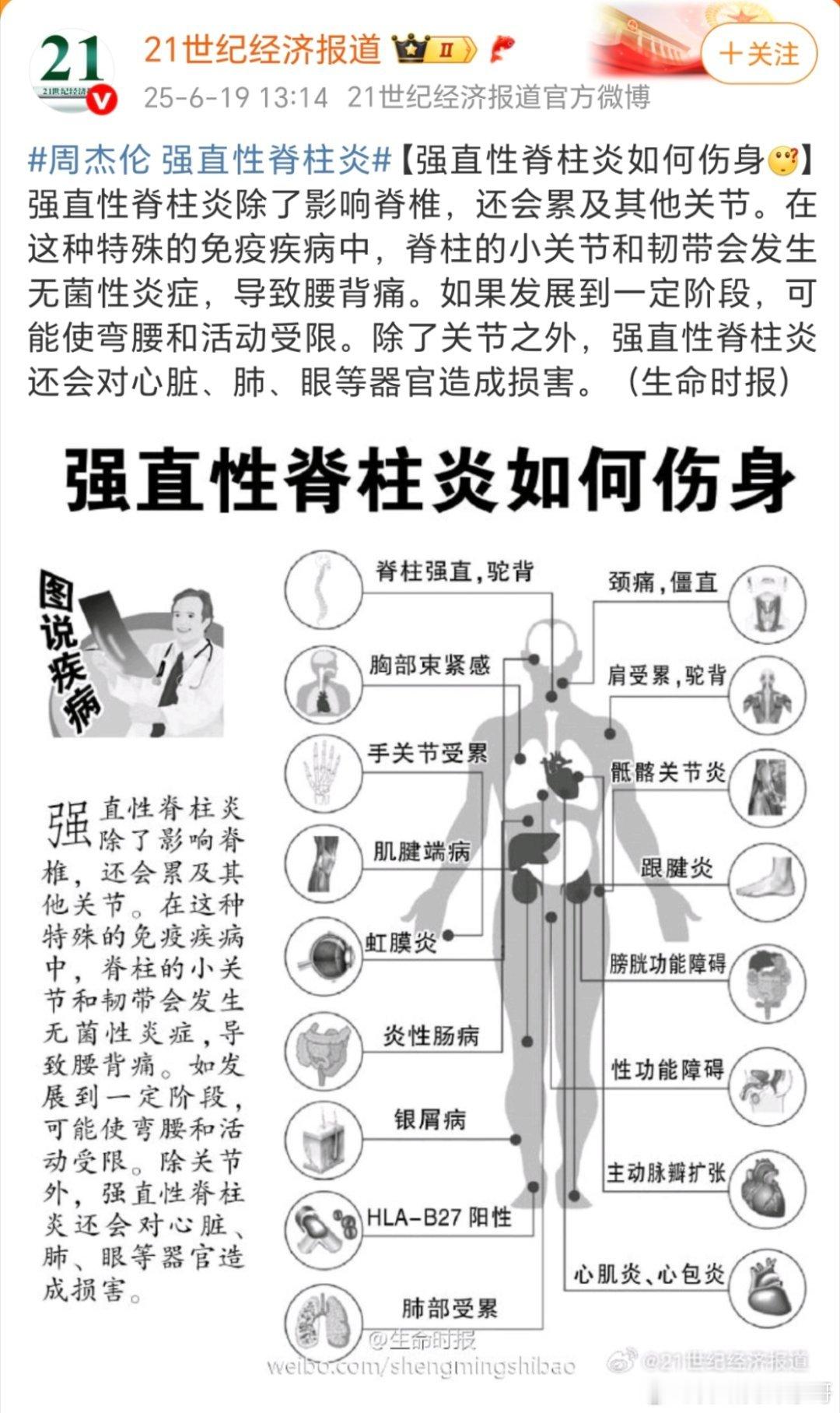 周杰伦 强直性脊柱炎这个病真的是有点绝绝子了，到现在都还没有有效的治疗方法！[黑