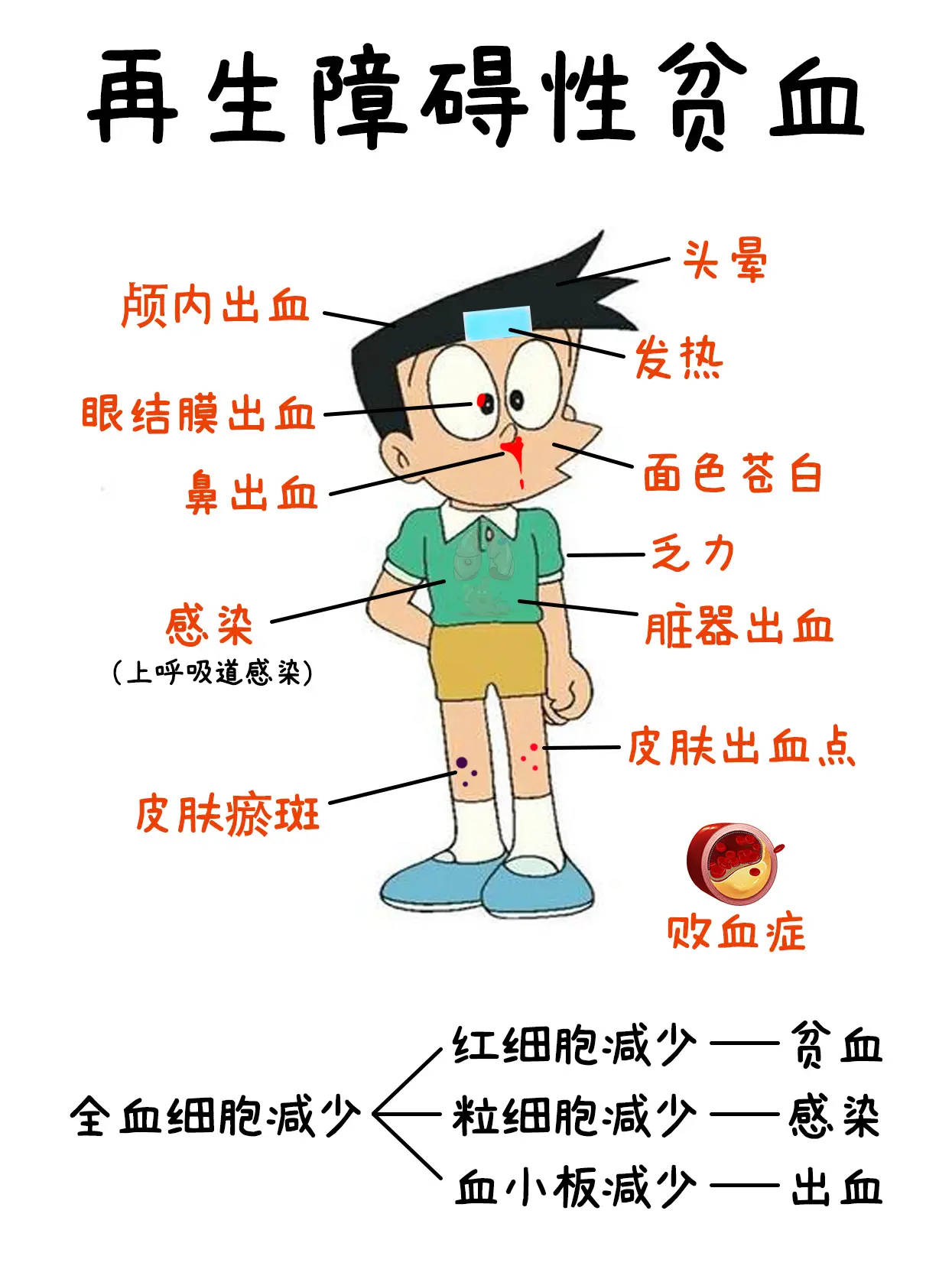 再生障碍性贫血。