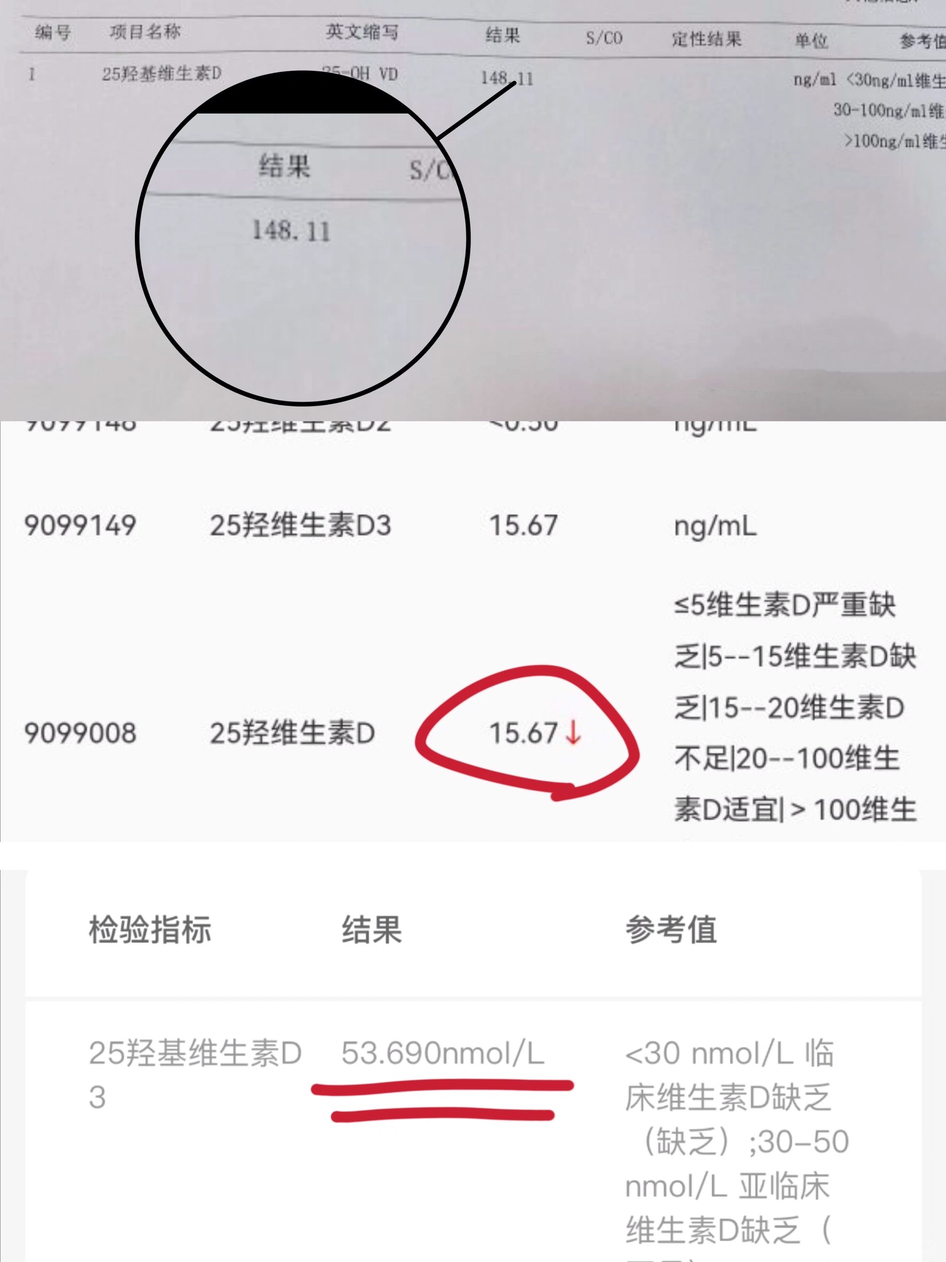 新手家长，哪个儿童要补维D，哪个过量了？