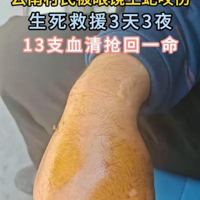 “打蛇不死反成仇”，5月10日报道，云南一名村民遭遇了一条长达2米、足有5斤重的