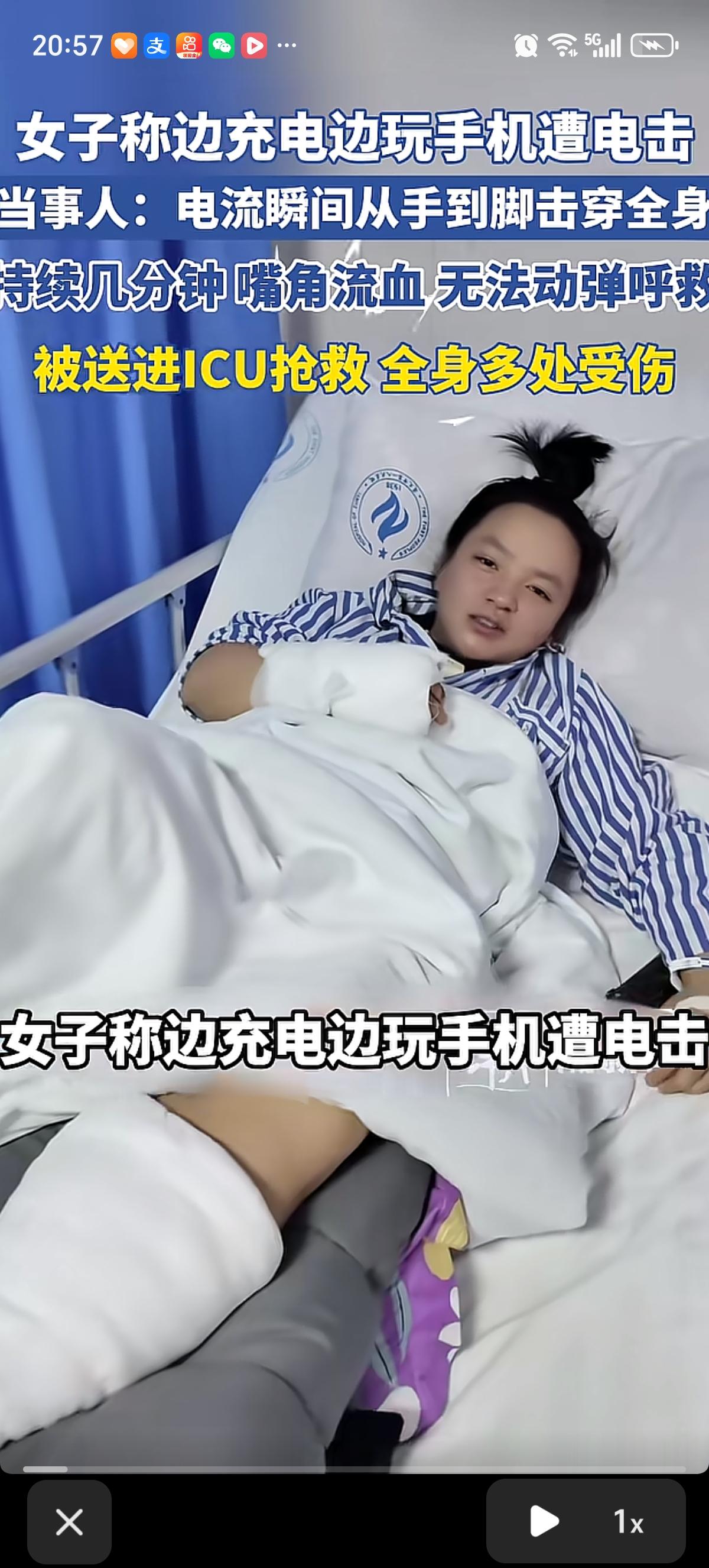 贵州遵义孙女士在家边充电边刷视频，突然遭遇严重电击。电流瞬间从手贯穿到脚，她全身