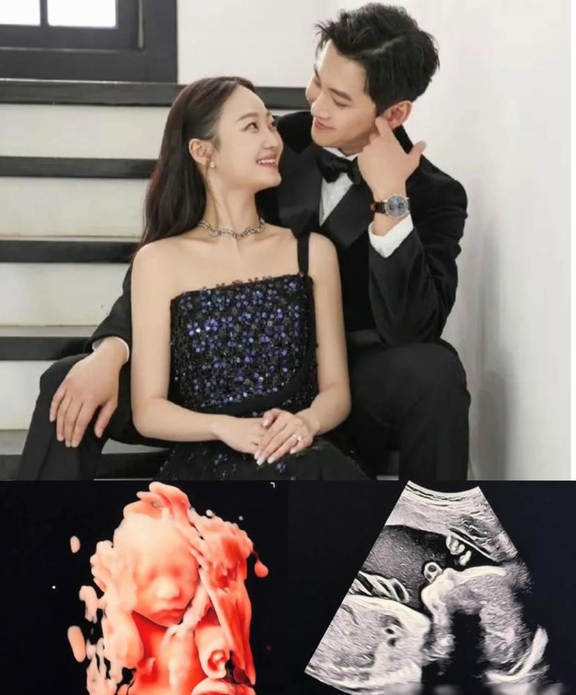 扔掉吉他拿起锅铲，前男团成员宋承炫直接在美国当爹了！
一张黑白B超图，一张3D