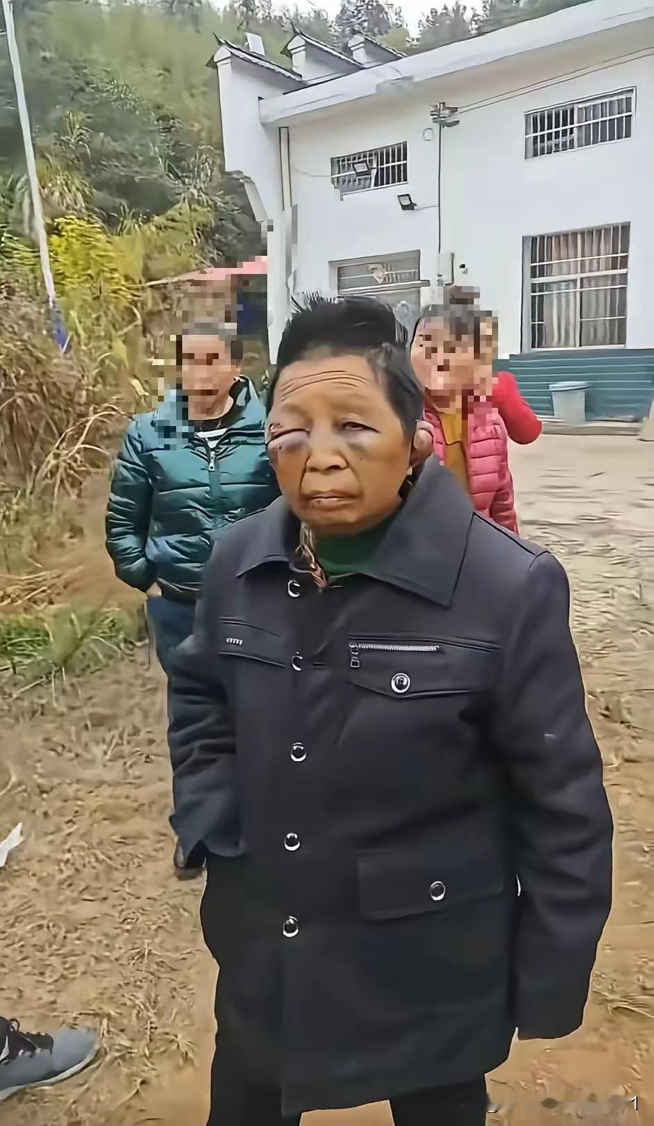 令人费解的是，直到女子被打成残疾人，才有人关注此事。倘若该事件未曝光，女子或许会