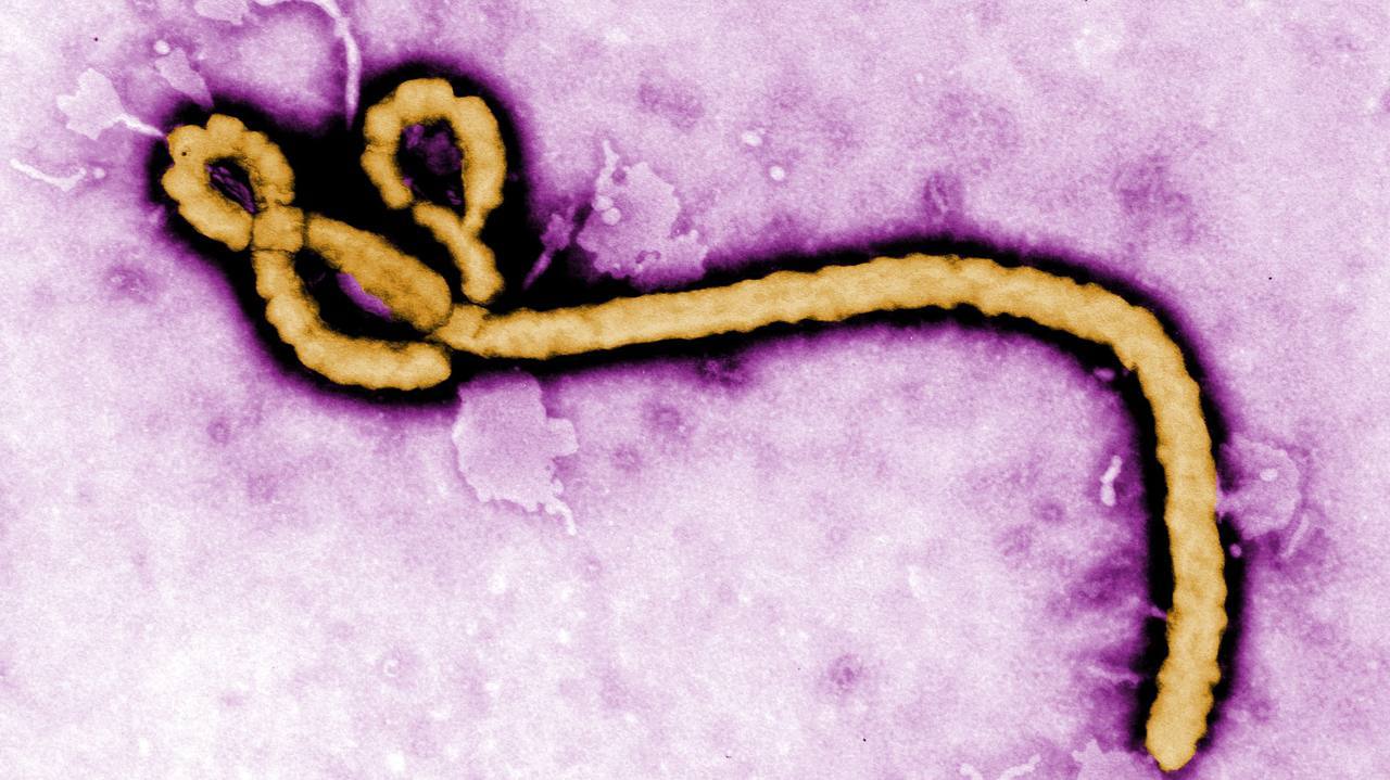 美国疾病控制与预防中心（CDC）称，一名在刚果民主共和国担任医生的美国基督教医疗