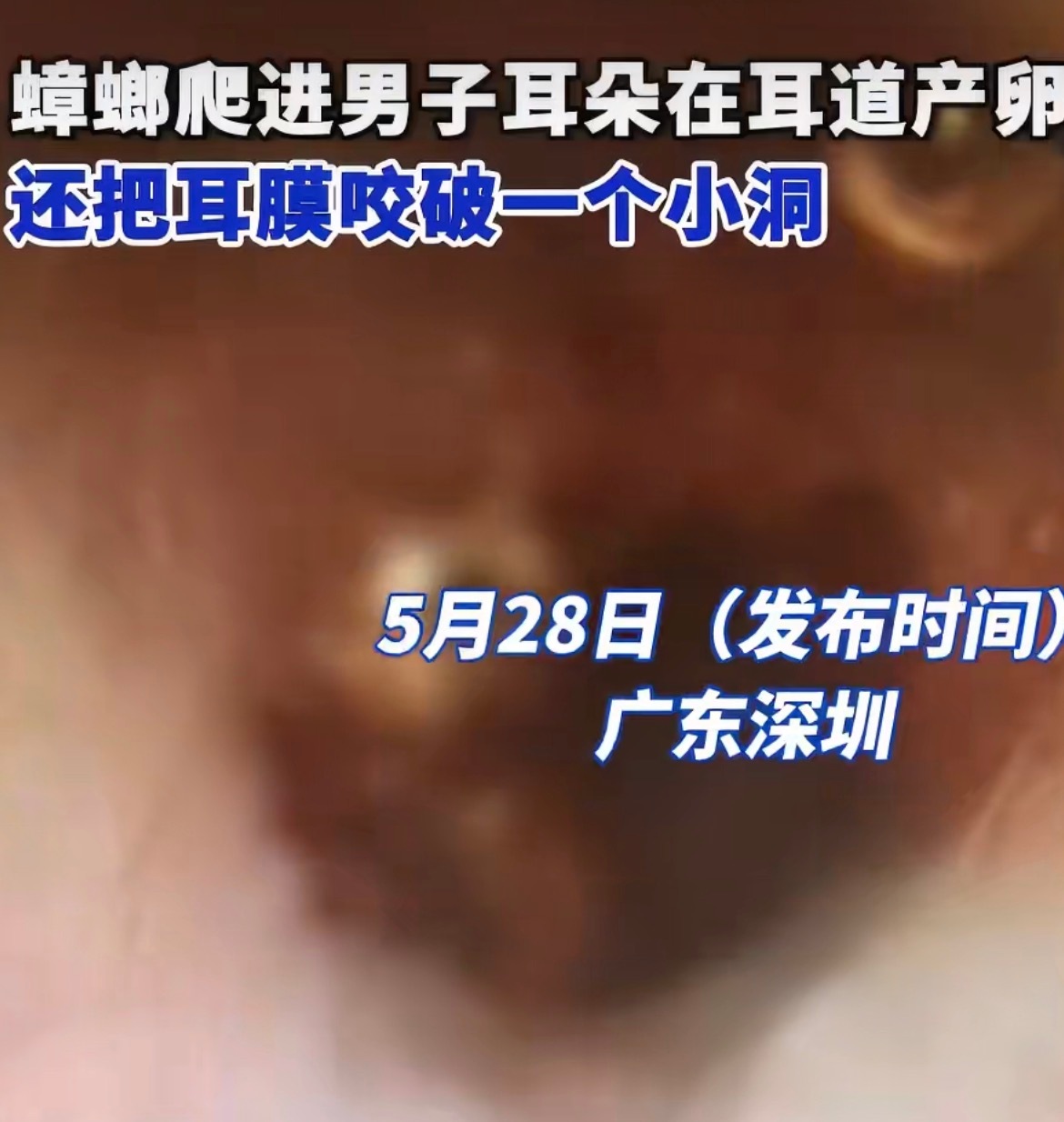 挖槽吓死我了