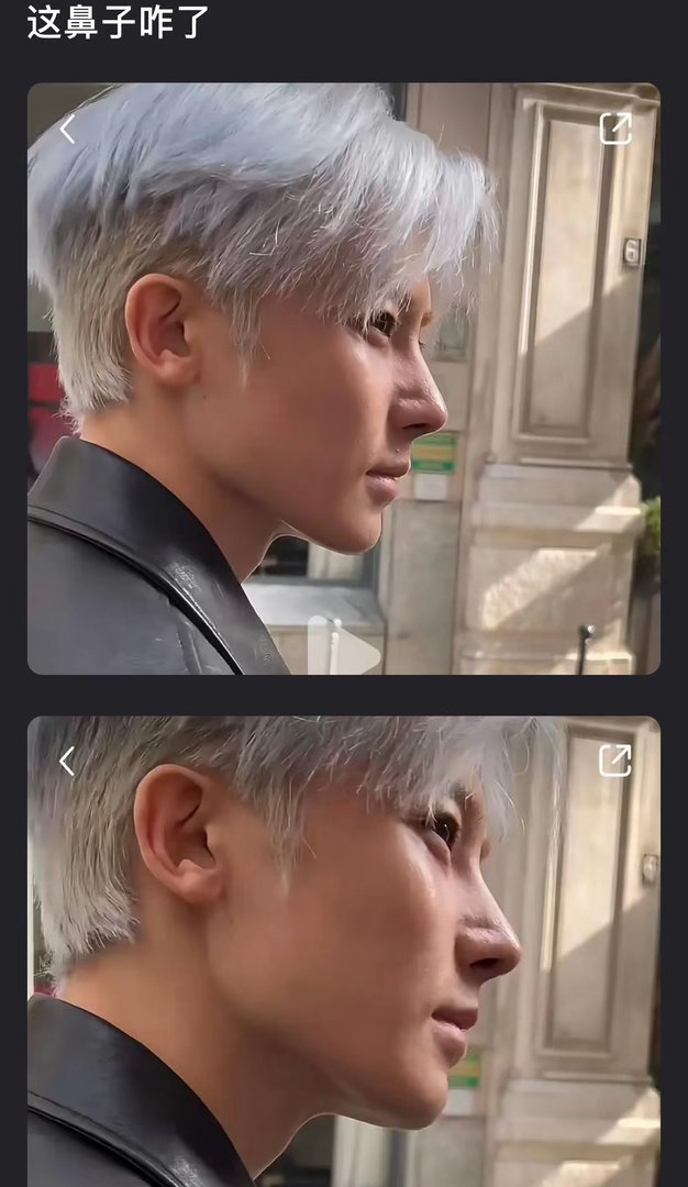 侯明昊的鼻子怎么了？ 