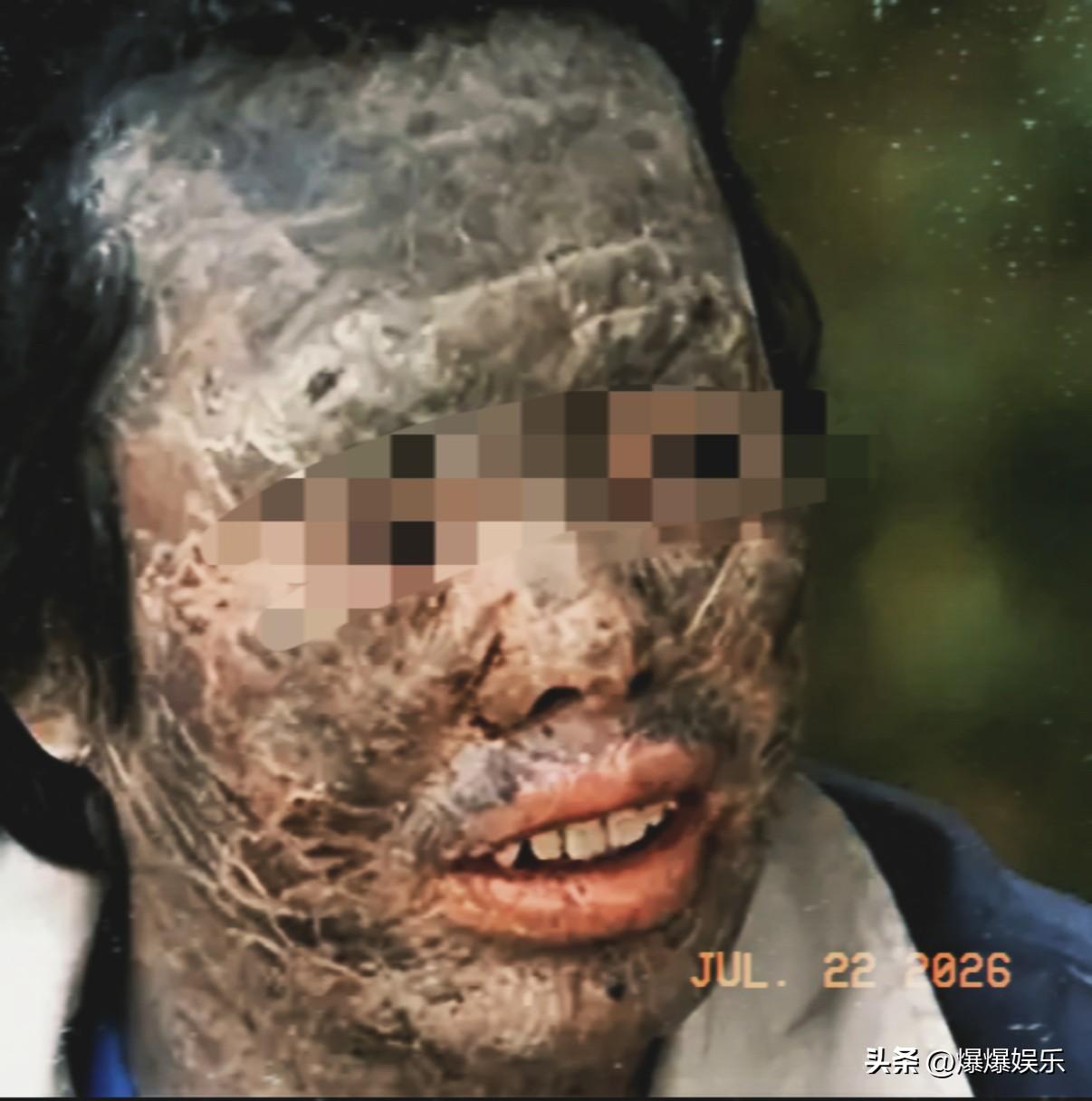 “吃蛇太多变蛇人？”辽宁村民韩永波有个怪癖，顿顿离不开蛇肉，还得现杀现吃。村里人