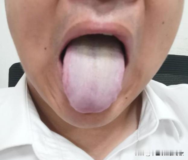 最近发现，这一入夏，阳虚患者那是大把大把的啊[狗头][狗头][狗头]
门诊大哥，