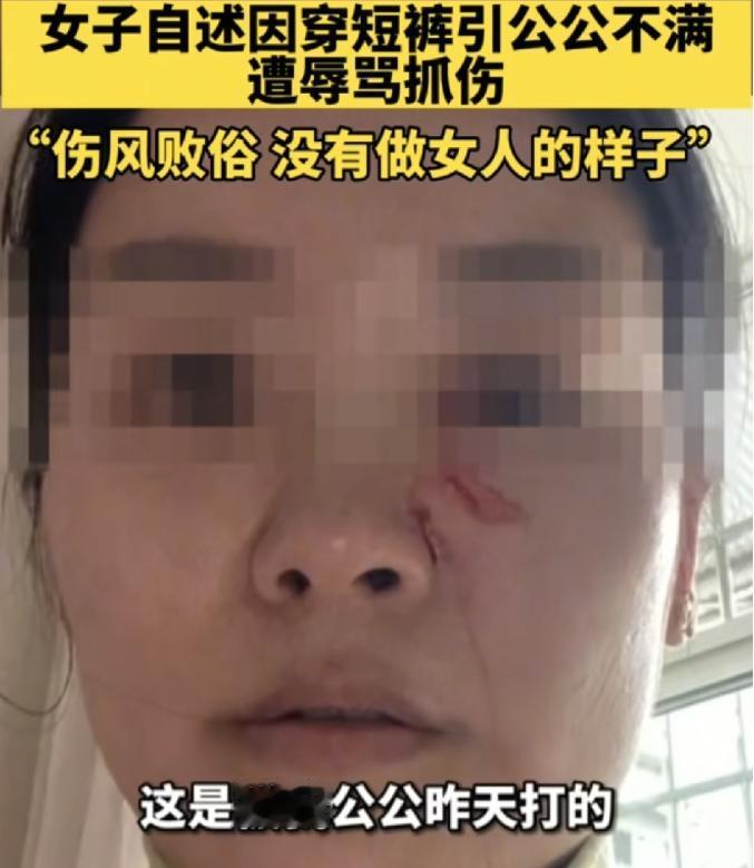 四川徐女士，就因为天太热，穿了条牛仔短裤，她公公就骂她伤风败俗、不要脸、没女人样