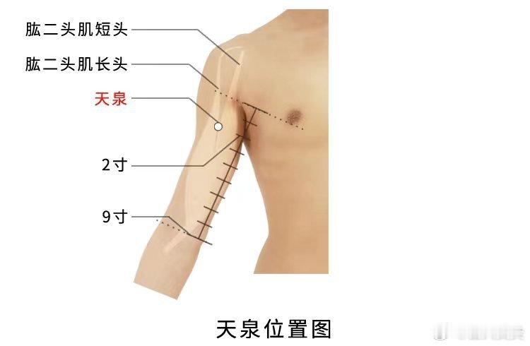  今日分享～天泉穴精准取穴：在臂前区，腋前纹头下2寸，肱二头肌的长、短头之间。功