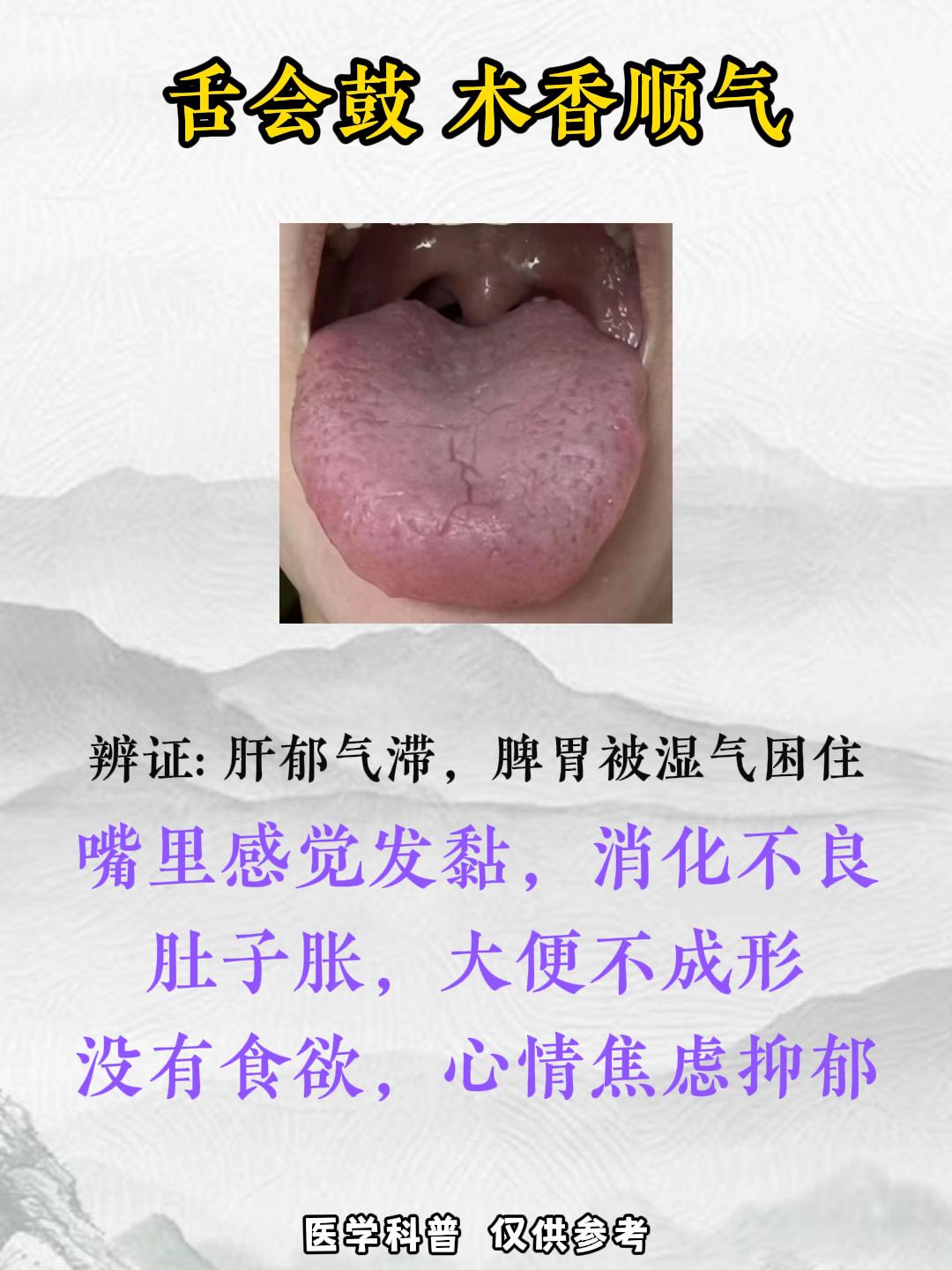 肝好寿命长，今天教你看舌调肝！

1.舌头鼓——肝郁气滞，脾胃被湿气困住了
2.