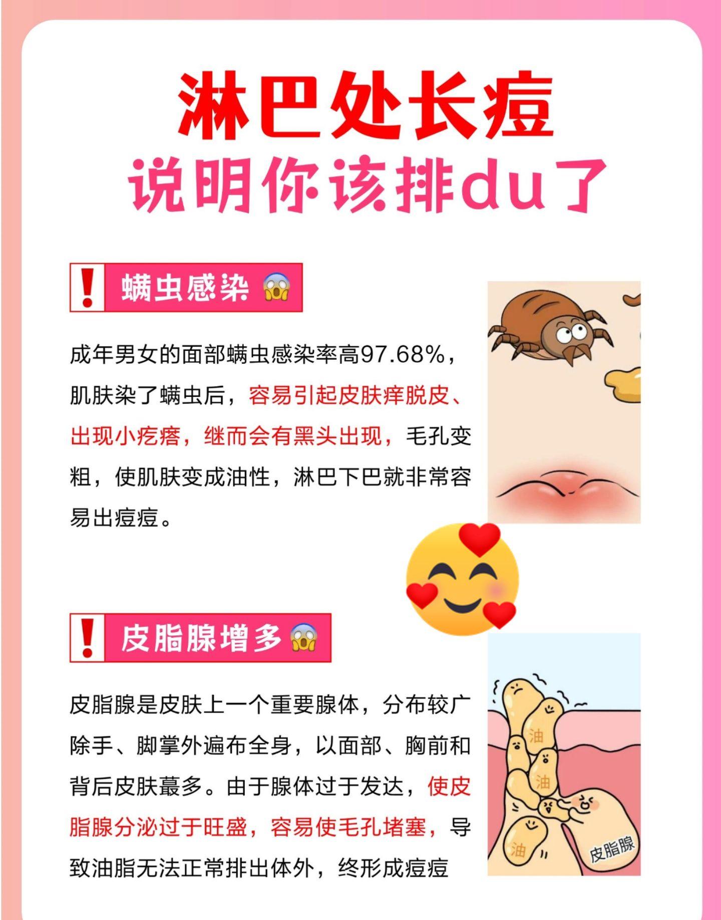 淋巴处长痘原来是你该排du了!!下颌痘痘长痘