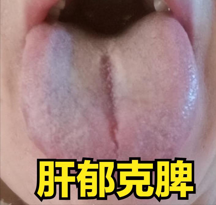 十个人，九个脾虚！中医看来多在肝郁！中医一剂方，专调肝脾


为什么说脾胃差，和