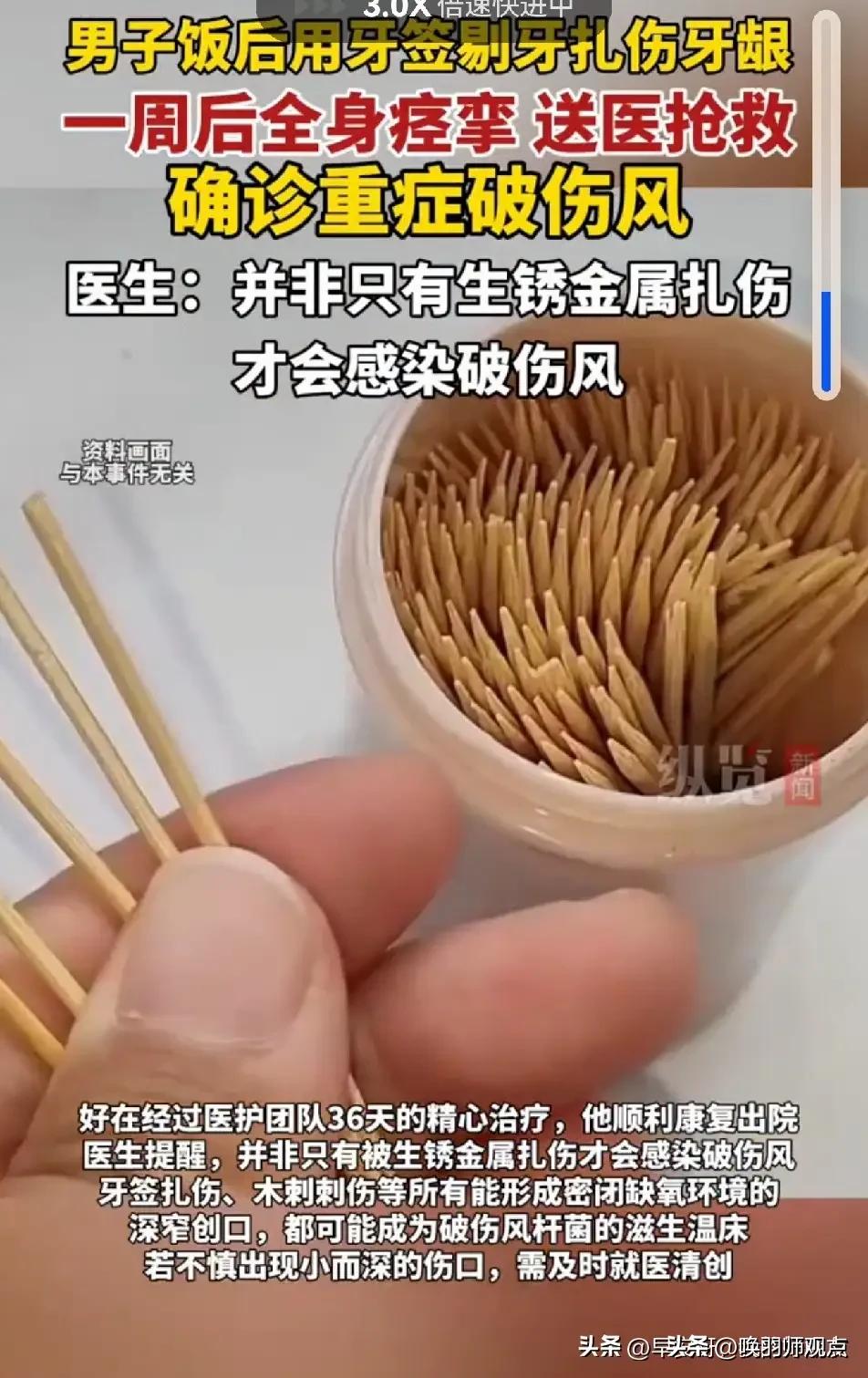 武汉张先生4月用竹牙签剔牙，扎伤牙龈，一周后出现张口困难、脖子僵硬、全身肌肉痉挛