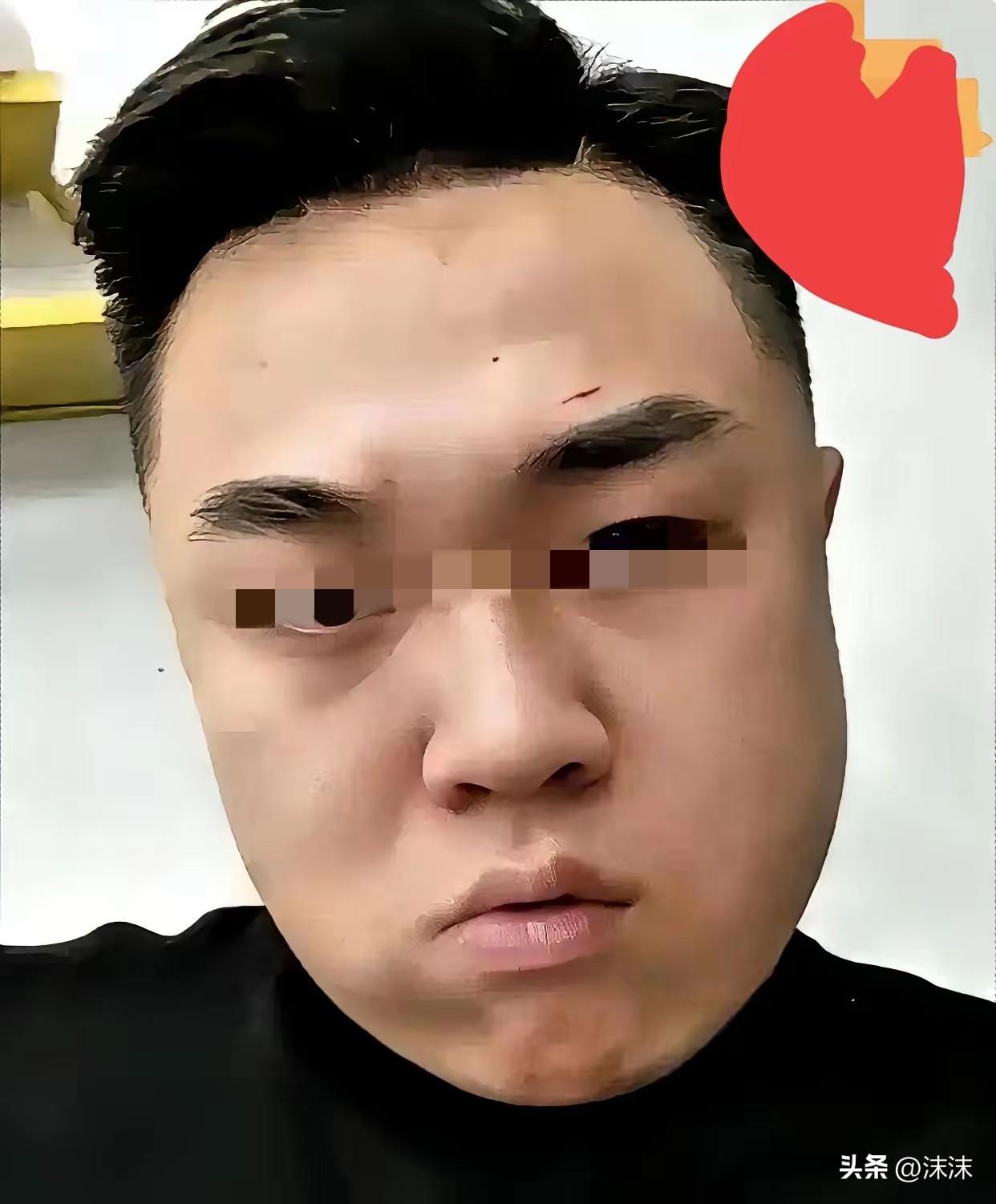 一纸伤情鉴定结果出来，有人彻底坐不住，真的，不是赔不起那点钱，是之前想的所有捷径