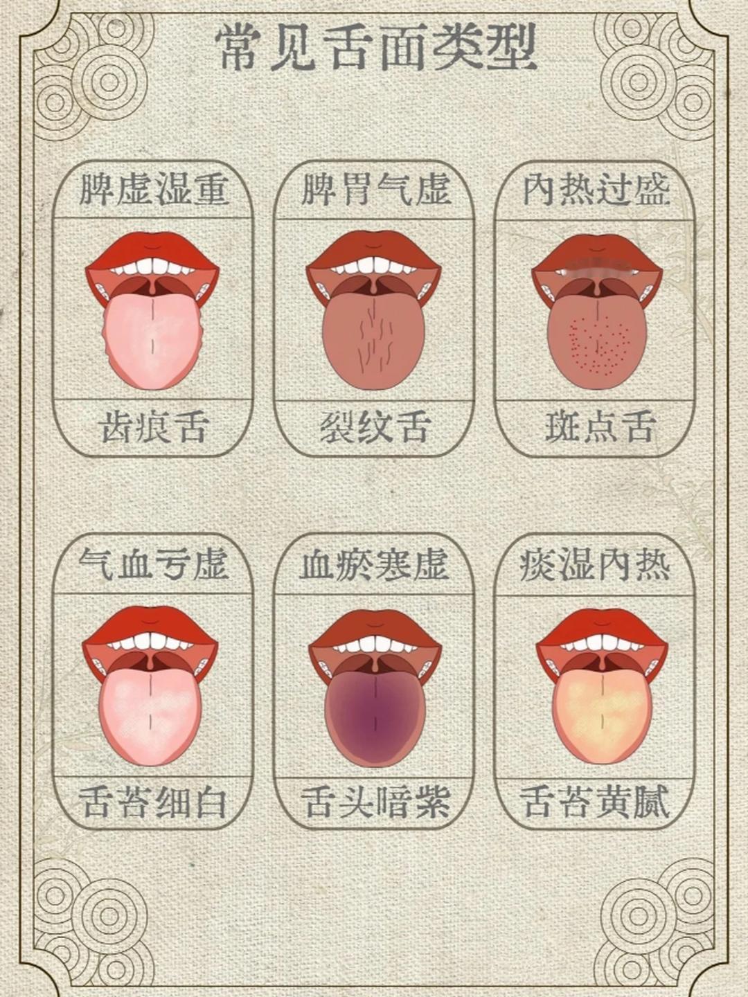 9种舌象，对应9种体质，快看看你是哪一种？1、阴虚体质，平时总觉得心里面烦躁，失